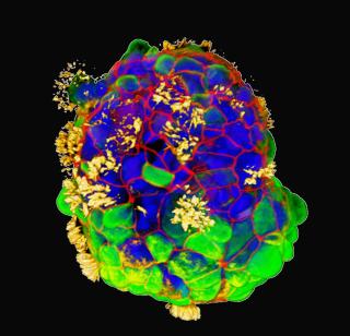 Confocal microscopy of an anthrobot with cilia