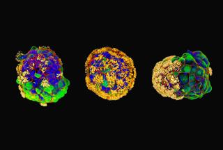 Confocal microscopy of three anthrobots